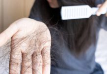 The Importance of Scalp Health in Preventing Hair Loss hair loss
