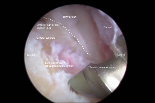arthroscopic surgeon arthroscopic surgeon
